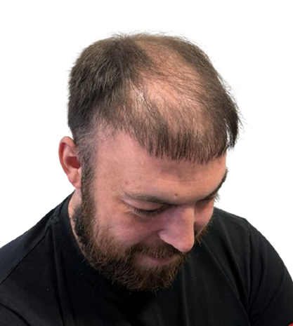 Before Image